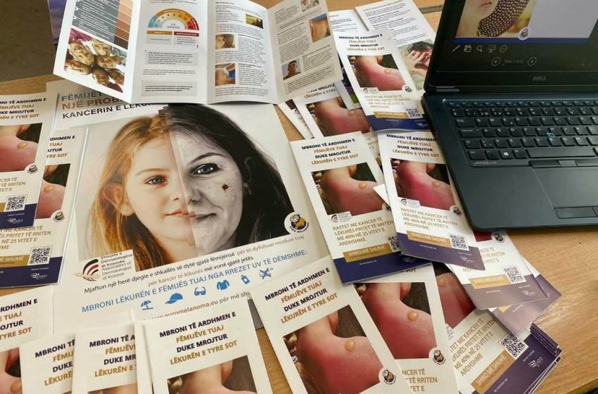Spitali i Përgjithshëm në Gjilan, organizon kampanjë sensibilizuese për kancerin e lëkurës